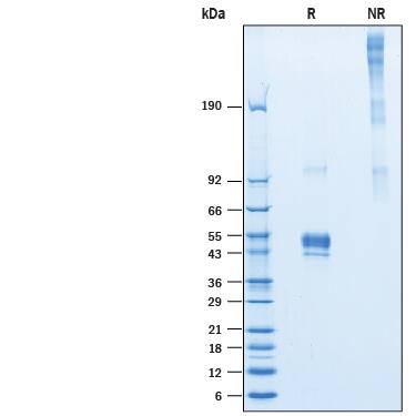 2 μg/lane of Recombinant Human Pentraxin 3/TSG-14 His-tag (Catalog # 10292-TS) was resolved with SDS-PAGE under reducing (R) and non-reducing (NR) conditions and visualized by Coomassie® Blue staining, showing bands at 38-55 kDa under reducing condition.