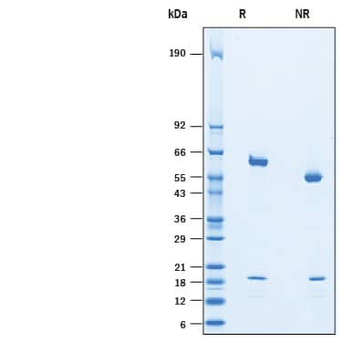 SDS-Page Proprotein Convertase 9/PCSK9 [Unconjugated]