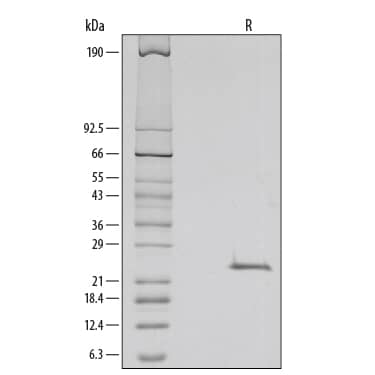 1 μg/lane of Recombinant Mouse R-Spondin-1 was resolved with SDS-PAGE under reducing (R) conditions and visualized by silver staining, showing a single band at 24 kDa.