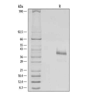 1 µg/lane of Recombinant Human R-Spondin 1 was resolved with SDS-PAGE and visualized by silver staining under reducing (R) conditions, showing a single band at 39 kDa.