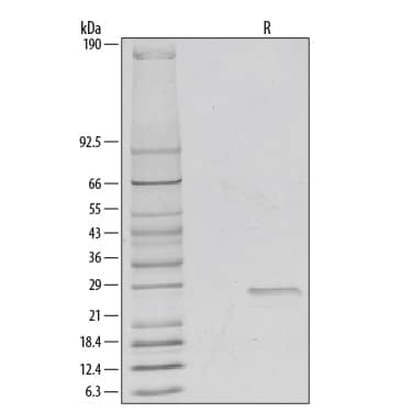 SDS-Page R-Spondin 2 [Unconjugated]