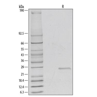 1 µg/lane of Recombinant Human R-Spondin 2 was resolved with SDS-PAGE and visualized by silver staining under reducing (R) conditions, showing a single band at 28 kDa.