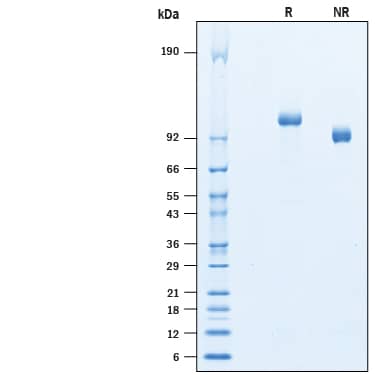 2 μg/lane of Recombinant Human RECK His-tag was resolved with SDS-PAGE under reducing (R) and non-reducing (NR) conditions and visualized by Coomassie® Blue staining, showing a band at ~110 kDa under reducing conditions.