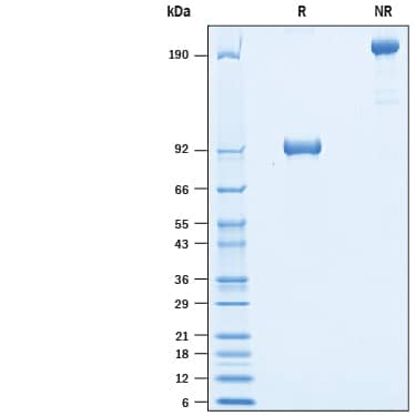 SDS-Page ROR1 [Biotin]