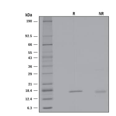 1 μg/lane of Recombinant Human Reg1B (Catalog # 2090-RG) was resolved with SDS-PAGE under reducing (R) and non-reducing (NR) conditions and visualized by silver staining, showing bands at 17.2 and 16.7 kDa, respectively.