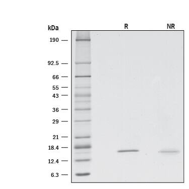 1 μg/lane of Recombinant Rat Reg3A (Catalog # 8347-RG) was resolved with SDS-PAGE under reducing (R) and non-reducing (NR) conditions and visualized by silver staining, showing bands at 16.5 and 16.1 kDa, respectively.
