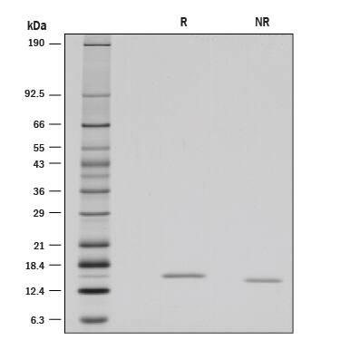 SDS-Page Reg3B [Unconjugated]