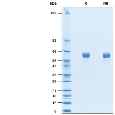 2 μg/lane of Recombinant Human SCG3 His-tag (Catalog # 10374-SC) was resolved with SDS-PAGE under reducing (R) and non-reducing (NR) conditions and visualized by Coomassie® Blue staining, showing bands at 50-70 kDa.