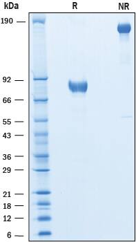 2 μg/lane of Recombinant Human SIRP beta 2 Fc Chimera was resolved with SDS-PAGE under reducing (R) and non-reducing (NR) conditions and visualized by Coomassie® Blue staining, showing bands at 77-85 kDa and 150-170 kDa, respectively.