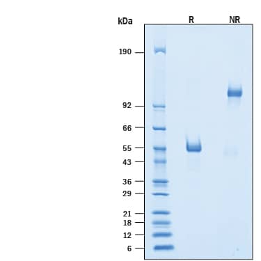 SDS-Page SIRP delta [Unconjugated]
