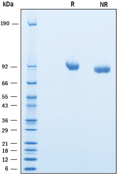2 μg/lane of Recombinant Mouse SLITRK2 was resolved with SDS-PAGE under reducing (R) and non-reducing (NR) conditions and visualized by Coomassie® blue staining, showing bands at 86-98 kDa respectively.