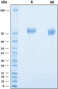 2 μg/lane of Recombinant Mouse SLITRK3 was resolved with SDS-PAGE under reducing (R) and non-reducing (NR) conditions and visualized by Coomassie® Blue staining, showing bands at 94-105 kDa.