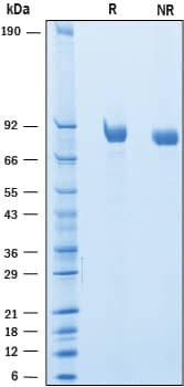 SDS-Page SLITRK6 [Unconjugated]