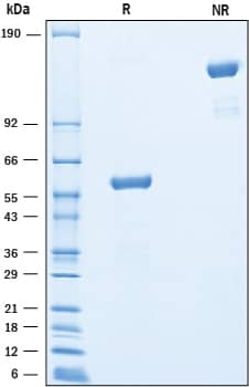 2 μg/lane of Recombinant Human TMED1 Fc was resolved with SDS-PAGE under reducing (R) and non-reducing (NR) conditions and visualized by Coomassie® Blue staining, showing bands at 56-62 kDa and 110-120 kDa, respectively.