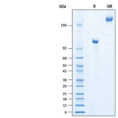 SDS-Page Semaphorin 4B [Unconjugated]