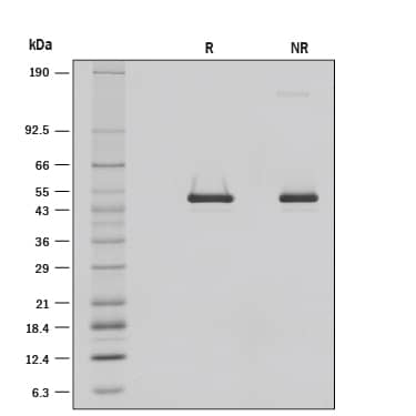 1 μg/lane of Recombinant Mouse Serpin F1/PEDF was resolved with SDS-PAGE under reducing (R) and non-reducing (NR) conditions and visualized by silver staining, showing R bands at 48.8, 42.5 kDa and NR bands at 140.8, 47.9, 42.1 kDa.