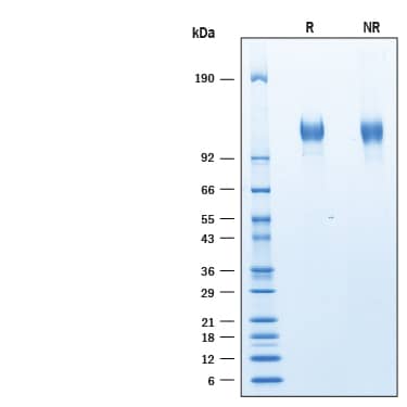 2 μg/lane of Recombinant Human Siglec-2/CD22 His-tag (Catalog # 10191-SL) was resolved with SDS-PAGE under reducing (R) and non-reducing (NR) conditions and visualized by Coomassie® blue staining, showing bands at 110-130 kDa.