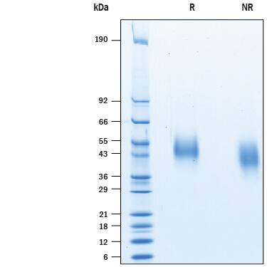 2 μg/lane of Recombinant Human Siglec-3/CD33 His-tag (Catalog # 10375-SL) was resolved with SDS-PAGE under reducing (R) and non-reducing (NR) conditions and visualized by Coomassie® Blue staining, showing bands at 44-55 kDa.