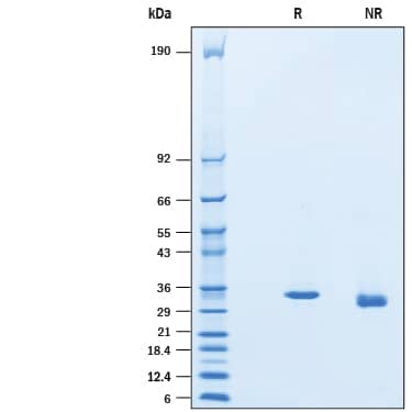 SDS-Page Sirtuin 5/SIRT5 [Unconjugated]