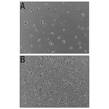 Recombinant Human Slit2 (Catalog # 9379-SL) Induces Cortical Neurite Outgrowth. A) Untreated E16-E18 embryonic rat cortical neurons. B) Neurite outgrowth in E16-E18 embryonic rat cortical neurons treated with 625 ng/mL of Recombinant Human Slit2.