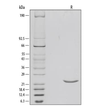 1 μg/lane of Recombinant Human Sonic Hedgehog/Shh, N-Terminus was resolved with SDS-PAGE under reducing (R) conditions and visualized by silver staining, showing a single band at 22 kDa.