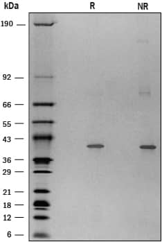 1 μg/lane of Recombinant Mouse TDO2 was resolved with SDS-PAGE under reducing (R) and non-reducing (NR) conditions and visualized by silver staining, showing bands at 39 kDa and 75 kDa under R conditions.