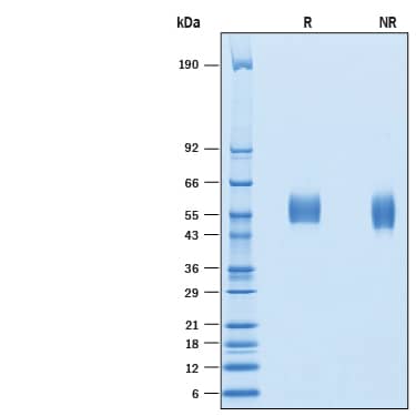 2 μg/lane of Recombinant Human TEM5/GPR124 His-tag (Catalog # 10206-TE) was resolved with SDS-PAGE under reducing (R) and non-reducing (NR) conditions and visualized by Coomassie® Blue staining, showing bands at 53-60 kDa.