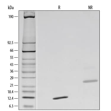 SDS-Page TGF-beta 2 [Unconjugated]
