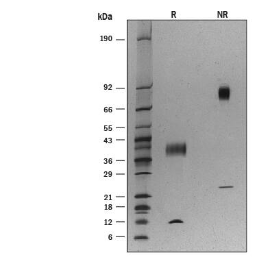 1 μg/lane of Recombinant Human Latent TGF‑ beta 1 was resolved with SDS-PAGE under reducing (R) and non-reducing (NR) conditions and visualized by silverstaining, showing bands at 11, 36-42 kDa (R) and 24, 80-95 kDa (NR).