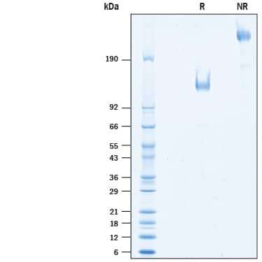 SDS-Page TIM-1/KIM-1/HAVCR [Biotin]