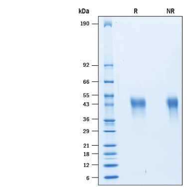 2 μg/lane of Recombinant Human TIM-3 Hist-tag (Catalog # 10241-TI) was resolved with SDS-PAGE under reducing (R) and non-reducing (NR) conditions and visualized by Coomassie® Blue staining, showing bands at 40-50 kDa.