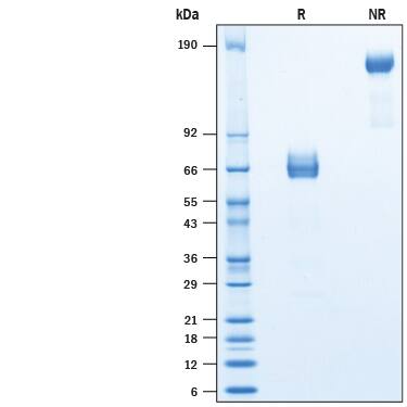 2 μg/lane of Recombinant Rat TIM-3 Fc Chimera Protein (10489-TM) was resolved with SDS-PAGE under reducing (R) and non-reducing (NR) conditions and visualized by Coomassie® Blue staining, showing bands at 60-75 kDa and 120-150 kDa, respectively.