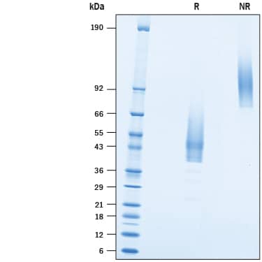 2 μg/lane of Recombinant Human TMEM119 Fc Chimera (Catalog # 10313-TM) was resolved with SDS-PAGE under reducing (R) and non-reducing (NR) conditions and visualized by Coomassie® Blue staining, showing bands at 37-57 kDa and 70-110 kDa, respectively.