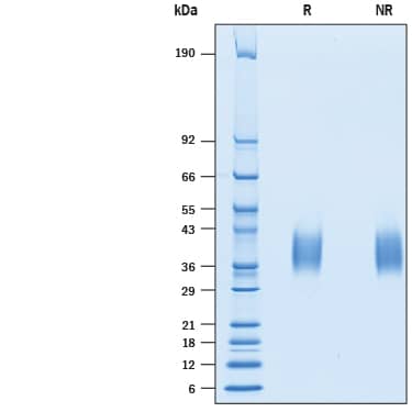 2 μg/lane of Recombinant Human TREM-1 His-tag (Catalog # 10337-TR) was resolved with SDS-PAGE under reducing (R) and non-reducing (NR) conditions and visualized by Coomassie® Blue staining, showing bands at 30-45 kDa.