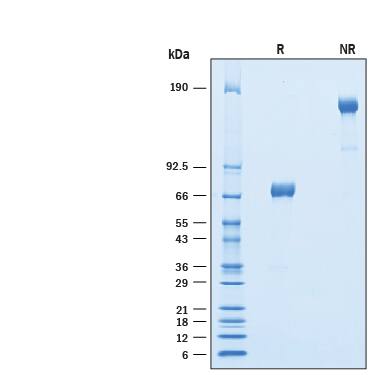 2 μg/lane of Recombinant Mouse TREML4/TLT-4 Fc Chimera (Catalog # 10172-TL) was resolved with SDS-PAGE under reducing (R) and non-reducing (NR) conditions and visualized by Coomassie® Blue staining, showing bands at 64-72 kDa and 120-150 kDa, respectively.
