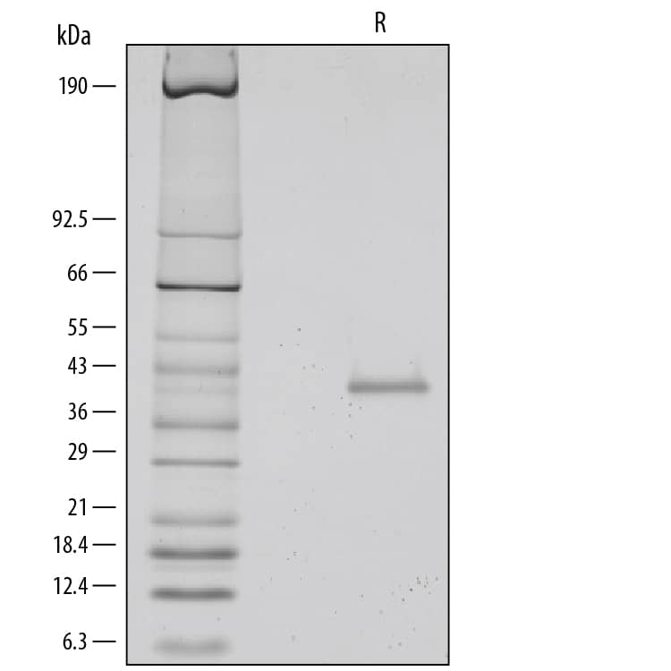 1 μg/lane of Recombinant Human TSG-6 was resolved with SDS-PAGE under reducing (R) conditions and visualized by silver staining, showing a single band at 40 kDa.