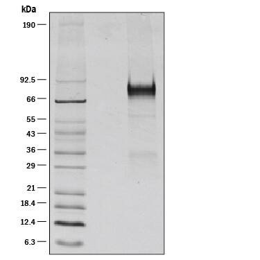 1 μg/lane of Recombinant Mouse Thrombopoietin/Tpo was resolved with SDS-PAGE under reducing (R) conditions and visualized by silver staining, showing a band at 80-90 kDa.
