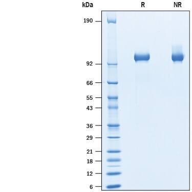 2 μg/lane of Recombinant Cynomolgus Monkey Tie-2 His-tag (Catalog # 10341-T2) was resolved with SDS-PAGE under reducing (R) and non-reducing (NR) conditions and visualized by Coomassie® Blue staining, showing bands at 96-107 kDa.