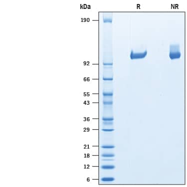 2 μg/lane of Recombinant Human Tie-2 His-tag Protein (Catalog # 10457-TI) was resolved with SDS-PAGE under reducing (R) and non-reducing (NR) conditions and visualized by Coomassie® Blue staining, showing bands at 98-111 kDa.