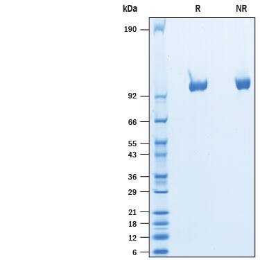 2 μg/lane of Recombinant Rat Tie-2 His-tag Protein (Catalog # 10458-T2) was resolved with SDS-PAGE under reducing (R) and non-reducing (NR) conditions and visualized by Coomassie® Blue staining, showing bands at 95-108 kDa.
