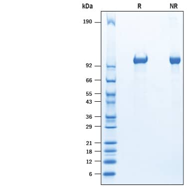 2 μg/lane of Recombinant Mouse Tie-2 His-tag Protein (Catalog # 10487-T2) was resolved with SDS-PAGE under reducing (R) and non-reducing (NR) conditions and visualized by Coomassie® Blue staining, showing bands at 95-110 kDa.