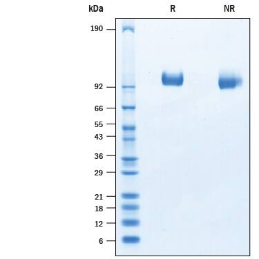 2 μg/lane of Recombinant Porcine Tie-2 His-tag Protein (Catalog # 10492-T2) was resolved with SDS-PAGE under reducing (R) and non-reducing (NR) conditions and visualized by Coomassie® Blue staining, showing bands at 90-105 kDa.