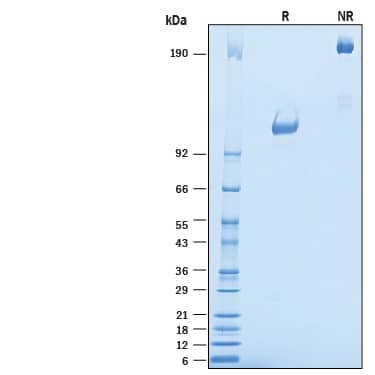 2 μg/lane of Recombinant Mouse TrkA Fc Chimera (Catalog # 10235-TK) was resolved with SDS-PAGE under reducing (R) and non-reducing (NR) conditions and visualized by Coomassie® Blue staining, showing bands at 100-125 kDa and 200-250 kDa, respectively.