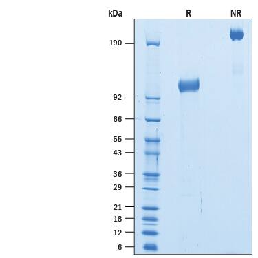SDS-Page TrkB [Unconjugated]