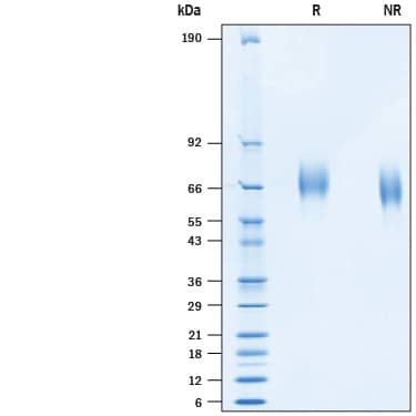 2 μg/lane of Recombinant Human Tyro3/Dtk His-tag (Catalog # 10365-DK) was resolved with SDS-PAGE under reducing (R) and non-reducing (NR) conditions and visualized by Coomassie® Blue staining, showing bands at 63-71 kDa.