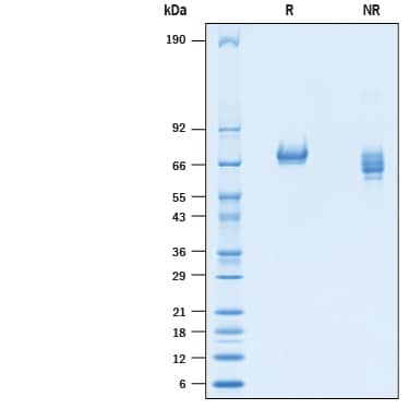 2 μg/lane of Recombinant Mouse Tyro3/Dtk His-tag Protein (Catalog # 10480-DT) was resolved with SDS-PAGE under reducing (R) and non-reducing (NR) conditions and visualized by Coomassie® Blue staining, showing bands at 60-75 kDa.