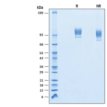 2 μg/lane of Recombinant Human VCAM-1/CD106 His-tag (Catalog # 10201-VC) was resolved with SDS-PAGE under reducing (R) and non-reducing (NR) conditions and visualized by Coomassie® Blue staining, showing bands at 80-110 kDa.
