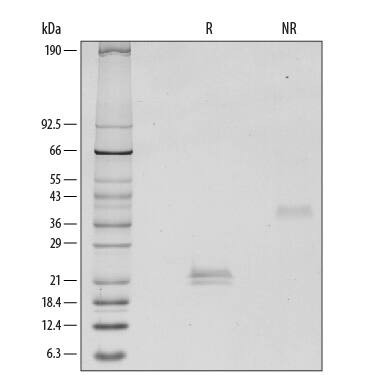 1 μg/lane of Recombinant Human VEGF165was resolved by SDS-PAGE with silver staining, under reducing (R) and non-reducing (NR) conditions, showing major bands at 20-22 kDa and 39-42 kDa, respectively. Multiple bands in gel are due to glycosylation.
