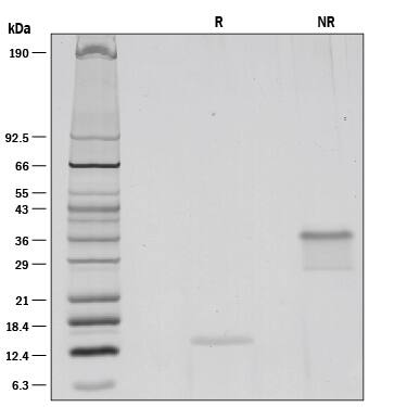 1 μg/lane of Recombinant Human VEGF (aa 207-318) was resolved with SDS-PAGE under reducing (R) and non-reducing (NR) conditions and visualized by silver staining, showing bands at 13 kDa and 36 kDa, respectively.