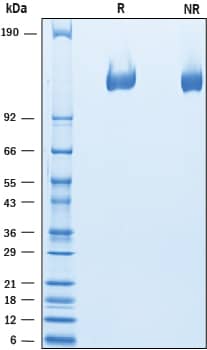 2 μg/lane of Recombinant Mouse VEGFR2/KDR/Flk‑1 His-tag (Catalog # 10095-KD) was resolved with SDS-PAGE under reducing (R) and non-reducing (NR) conditions and visualized by Coomassie® Blue staining, showing bands at 120-132 kDa.